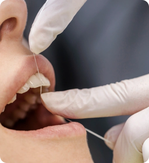 Professionelle Zahnreinigung